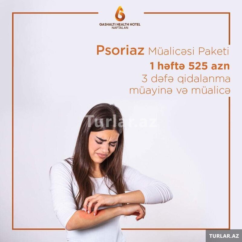 Psoriaz mualicə Paketi